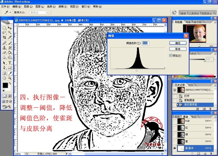 Photoshop给满脸雀斑的儿童照片磨皮
