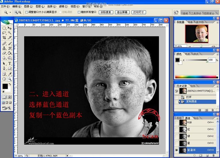 Photoshop给满脸雀斑的儿童照片磨皮