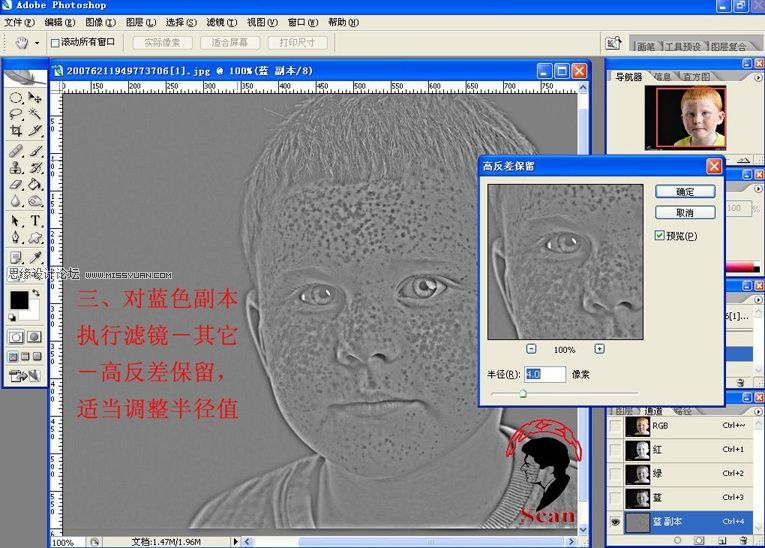 Photoshop给满脸雀斑的儿童照片磨皮