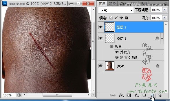 Photoshop合成人物缝合的伤口效果教程,PS教程,图老师教程网