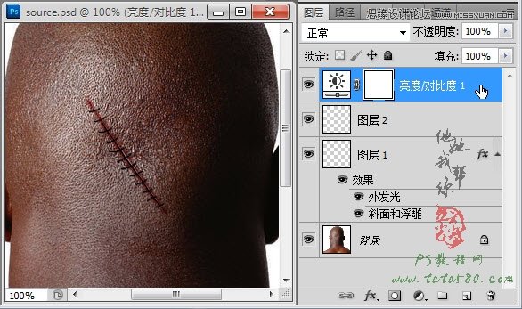 Photoshop合成人物缝合的伤口效果教程,PS教程,图老师教程网