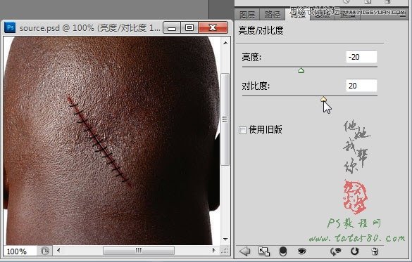 Photoshop合成人物缝合的伤口效果教程,PS教程,图老师教程网